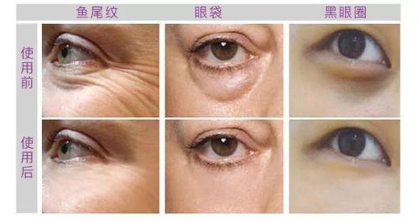 按摩 女人过了30岁，别“太节俭”！多在这3处下功夫，让你精致优雅又显年轻