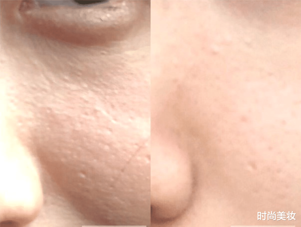 时尚美妆|张嘉倪长期使用5年美容仪，如今变成啥样了？老公：不敢相信