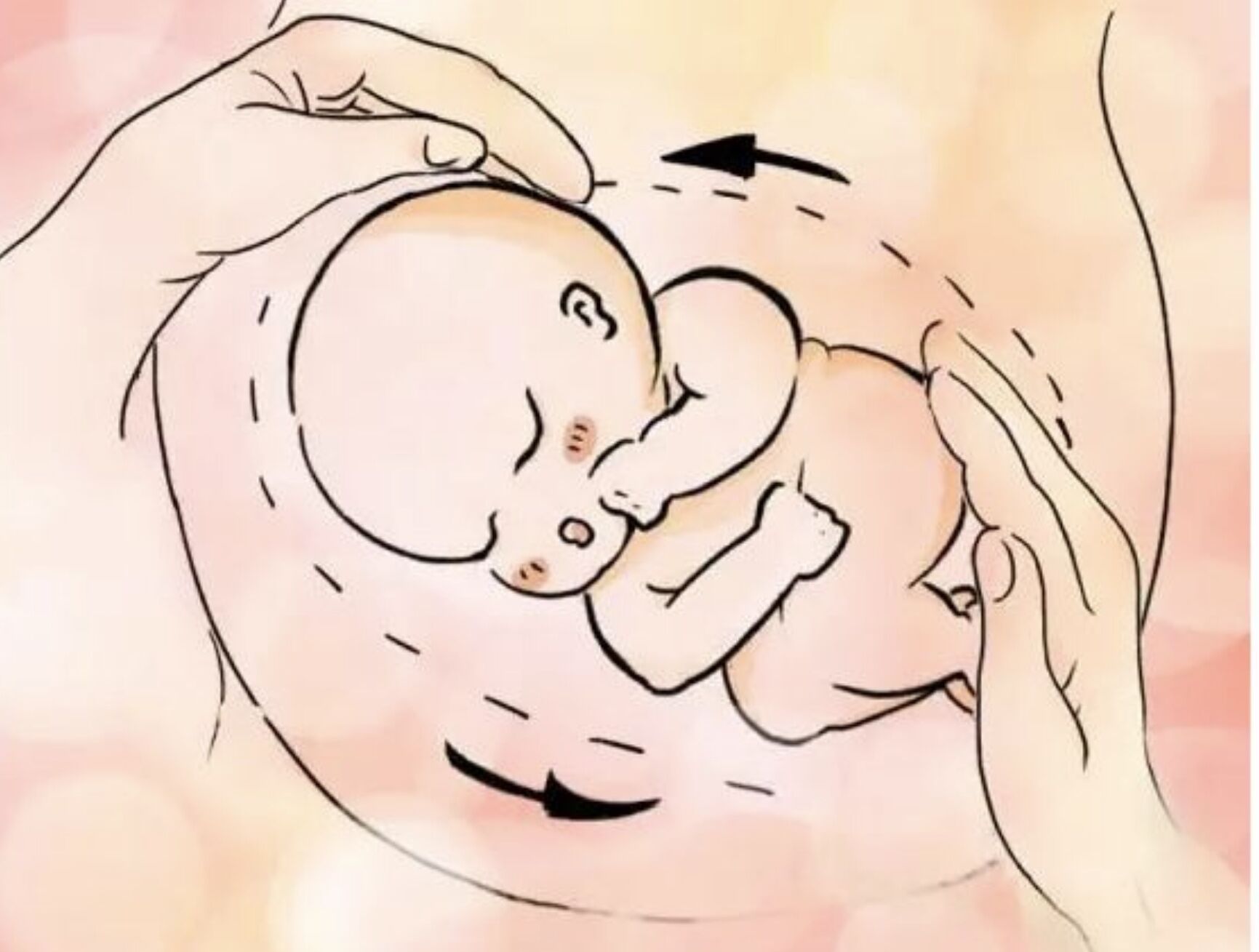 艳燕聊育儿|孕晚期胎位不正怎么办？看看这位孕妈怎么做！