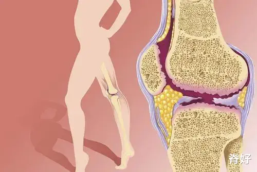 哮喘|腰腿痛的病因，全在这里了！（干货收藏）