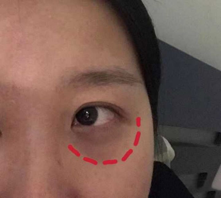 睡眠|经常失眠到两三点,甚至四五点,太痛苦了,怎么办还有救吗?