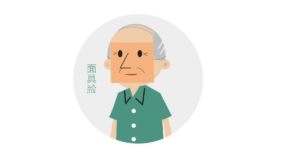 大舒飞|被人称为“僵尸脸”和“鬼脸病”的帕金森