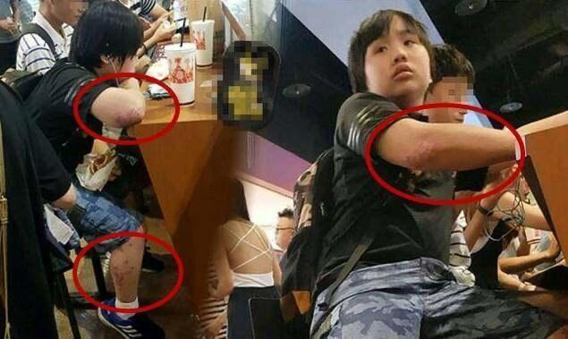 小小彬|他在“一夜爆火”后偷偷退圈，全网狂喜：这碗饭真的不适合你！