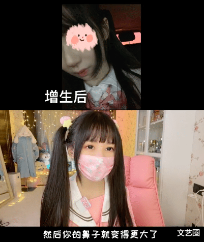 蔡萝莉|网红蔡萝莉承认整容失败，奉劝网友们不要整容，勇敢公布整容照片，鼻子已修复