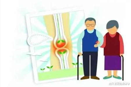 类风湿医生魏琳琳|中老年人应该如何预防骨关节炎？