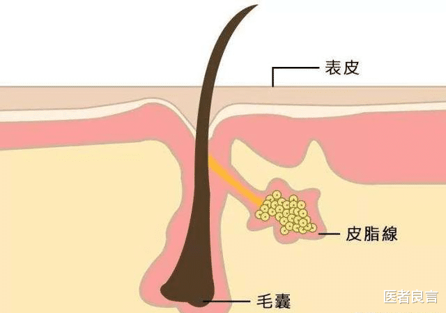 医者良言 头上长了很多红色小疙瘩，是怎么回事？