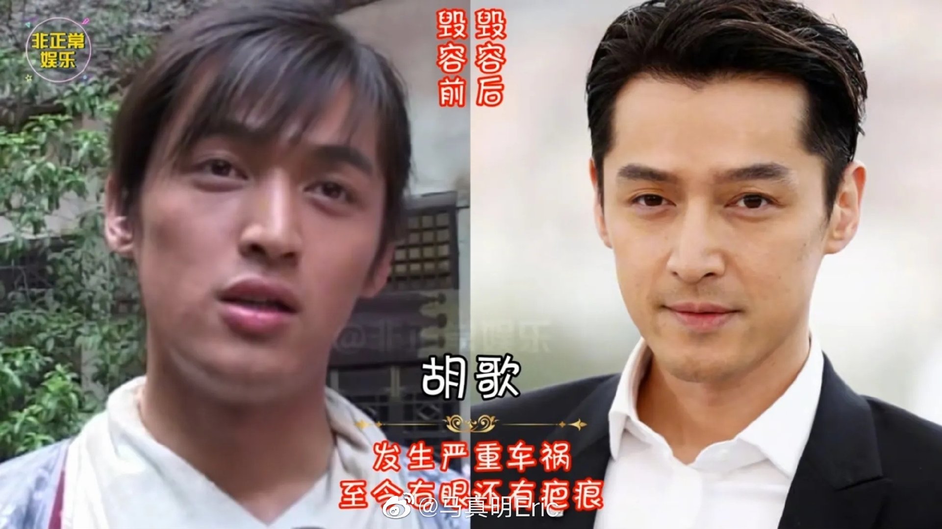 谢孟伟|五位明星意外毁容，最后一个却意外好看。