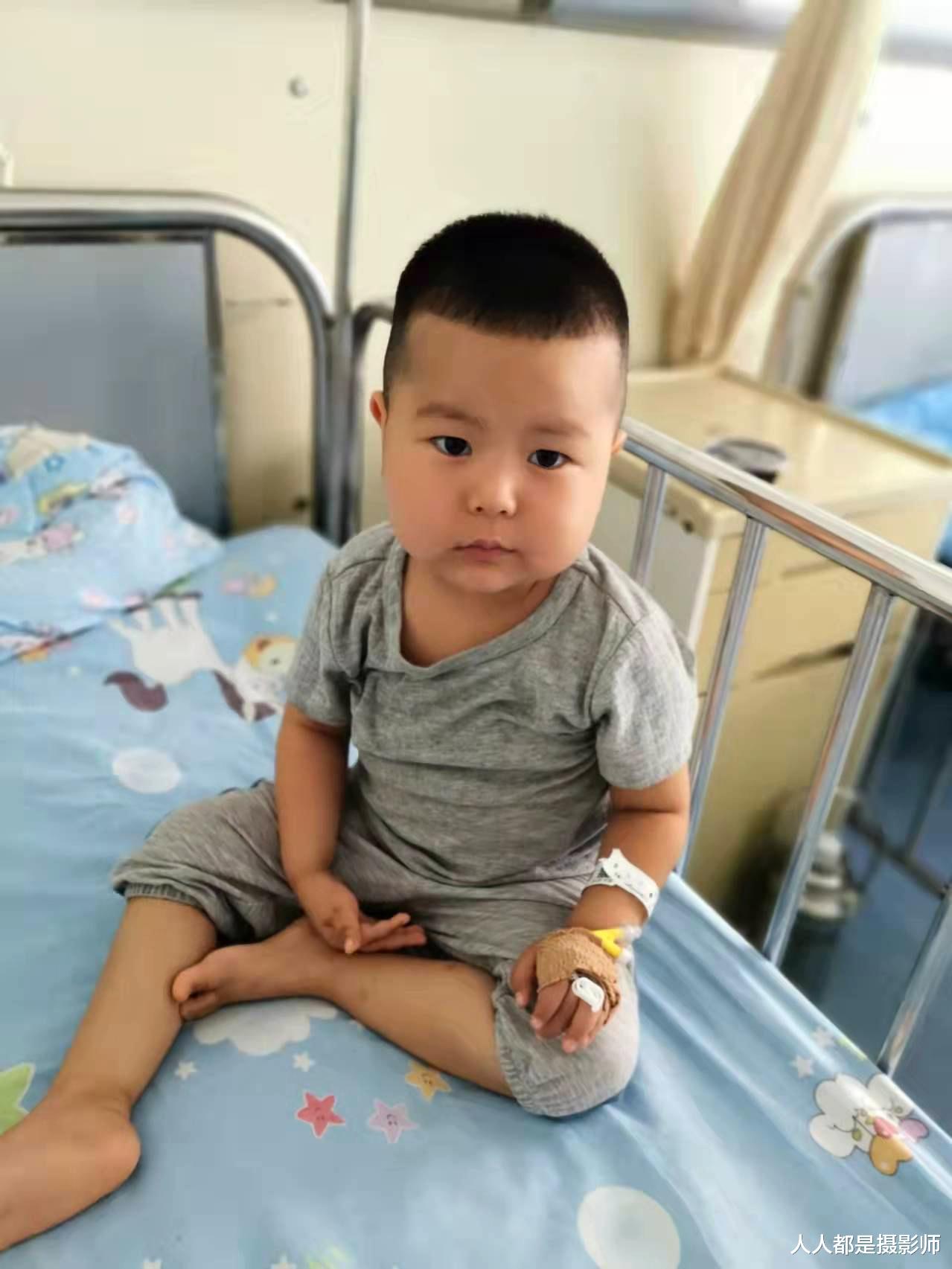 肾病|男孩高烧查出重病，2年做17次腰穿又复发，爸爸摔倒也查出肾病