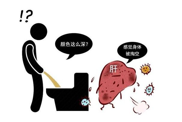 疾病|近期尿液泡沫多、异味重？医生劝你：尽快排查这3种病，别忽视！