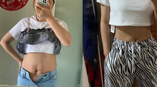 fashion美尚|那些号称可以“预防妊娠纹”的方法和乳油膏霜，原来都是智商税