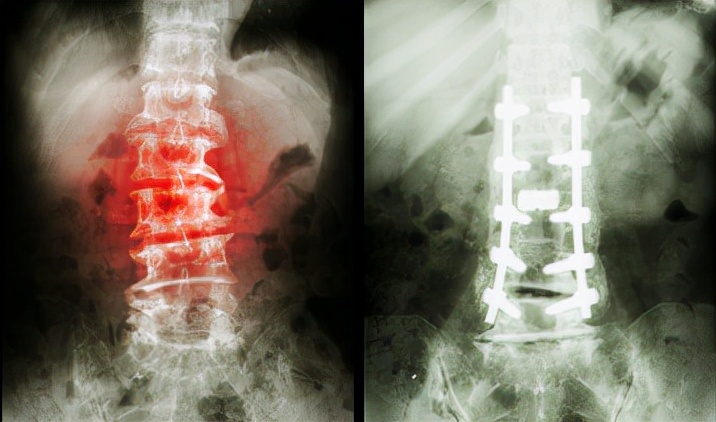 医生|腰间盘突出是“作”出来的？医生：4个坏习惯是“罪魁祸首”，趁早改掉