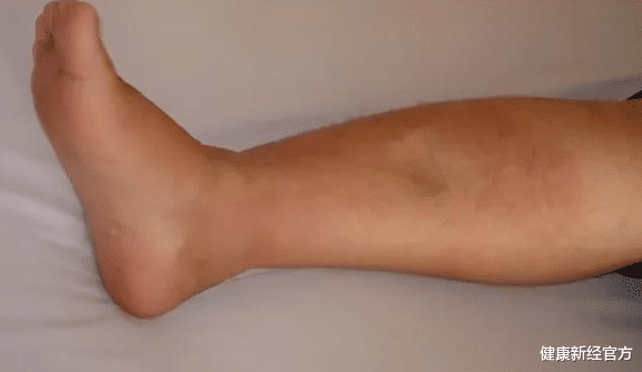 医生|养肾“冠军”被发现, 不是羊肉, 医生: 随便吃, 肾脏或变“少年状”