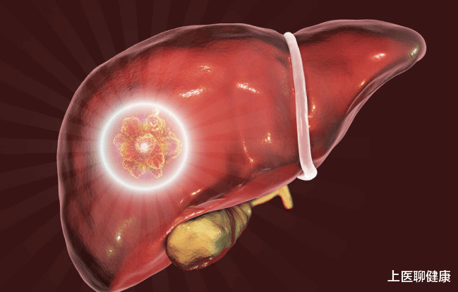 肝脏|身体2处“变黑”,八成是肝癌前兆!忠告:3种食物赶快撤下餐桌
