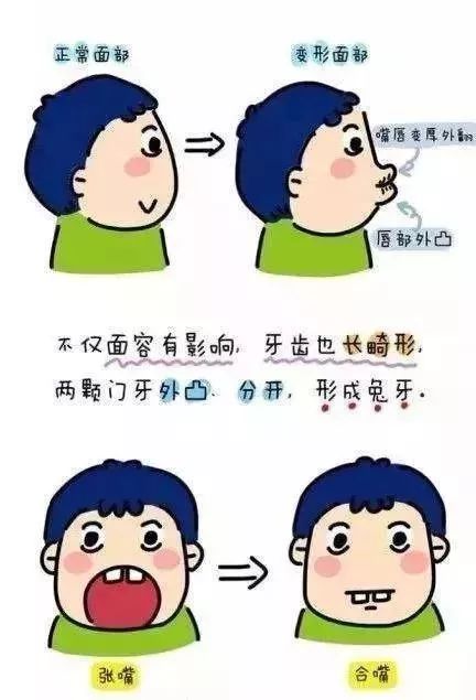 鼻炎|小儿推拿杨晓：鼻炎给孩子健康带来威胁，如何做好护理及治疗？