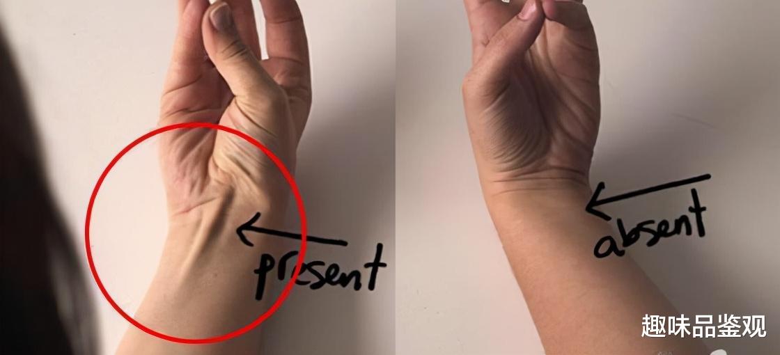 基因 人类最稀有的9种基因，全球拥有者仅5%，看看你有吗