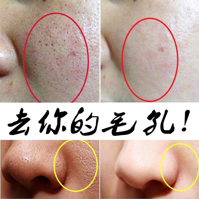 护肤品|护肤品能有效缩小毛孔吗？一次性告诉你，收缩毛孔真正有效的方法！