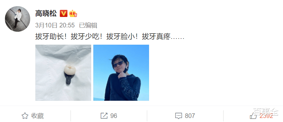 高晓松|高晓松剪掉25年长头发！肚子平坦不见赘肉，曾26天减掉26斤