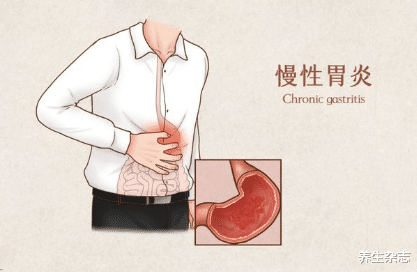 养生杂志|女子频繁腹泻，查出胃炎，医生劝告：不想胃“烂掉”，2种蔬菜赶紧扔