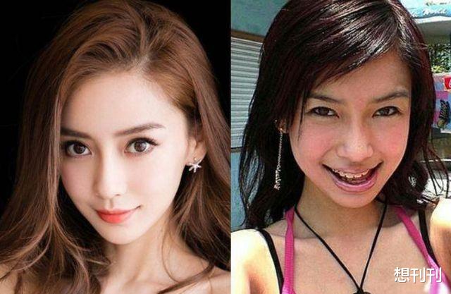 整形|明星的N种“假下巴”，尖到戳死人，翘成老巫婆，一个比一个怪异