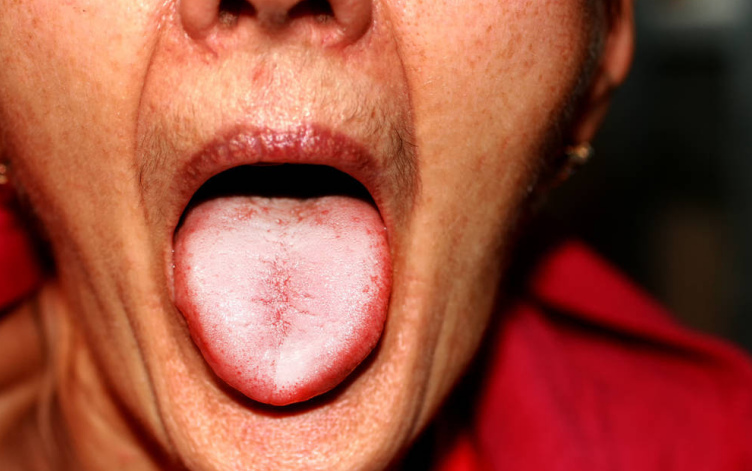 苹果|吃一次等于喝3次马桶水，很多人不当回事，医生：愚昧！那是自毁肝脏