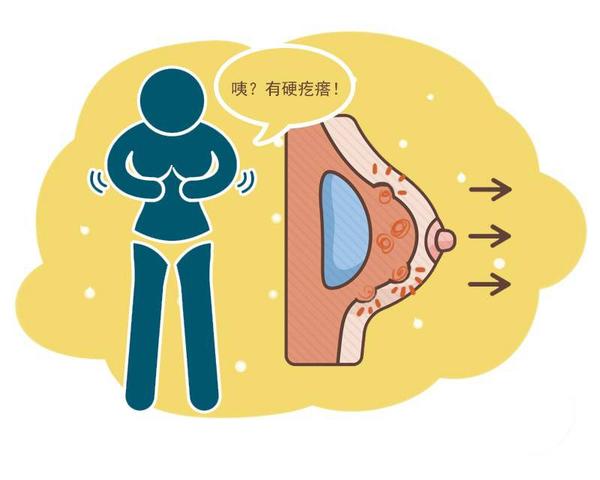 医说健康 乳腺癌发展时，身体会有4个典型症状，女性需重视，及时检查