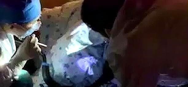 心中的陪伴 广州：一男子骑单车，臀部被铁架刺穿，网友：想想都疼