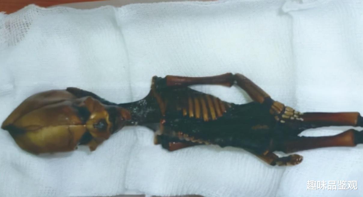 翟志刚 外星人阿廖申卡事件2：神秘生物被解剖，身体结构完全不同于人类