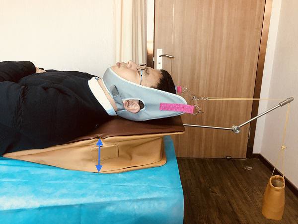心安勿想 拔罐可以治疗颈椎病吗？这些方法是，远离颈椎病的有效方法！