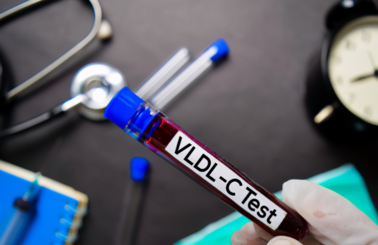 高血脂|高血脂患者注意：这4种食物是血脂“加速器”！常吃，血脂会飙升