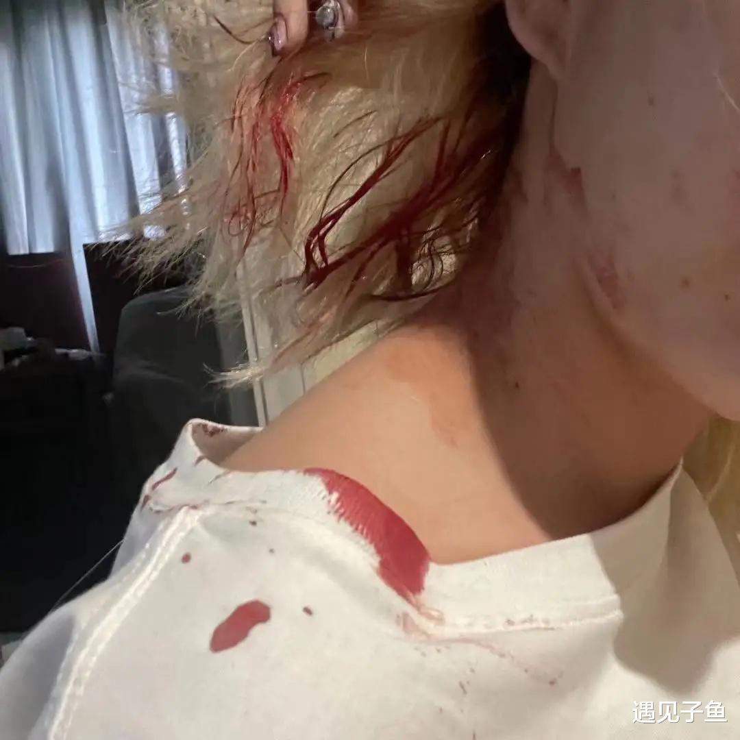 遇见子鱼|美女网红被男友暴打，绝望中被邻居姐姐解救，网友：男友面相够狠
