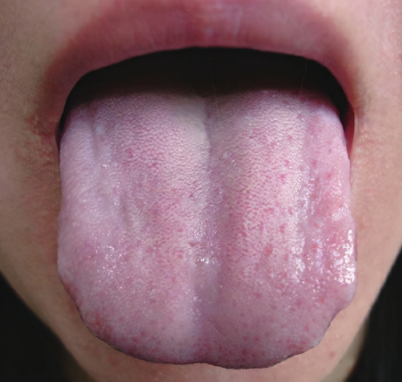 龟板|阴阳两虚，先补阴还是先补阳？解读阴阳双补方—龟鹿二仙胶