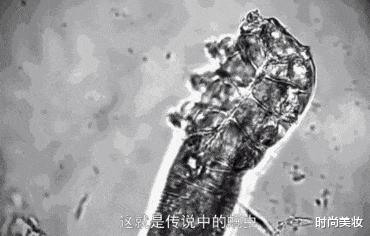 时尚美妆|提醒：“螨虫脸”的人，有这3个明显感觉，说明螨虫“缠上”你了