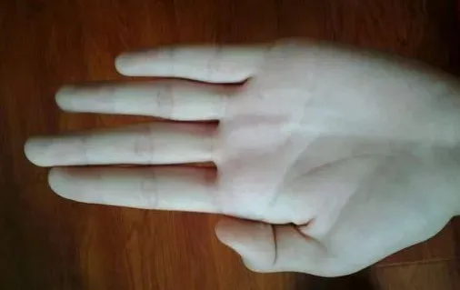 医养库|肝病第一个信号就在皮肤上！还不赶紧看一眼？