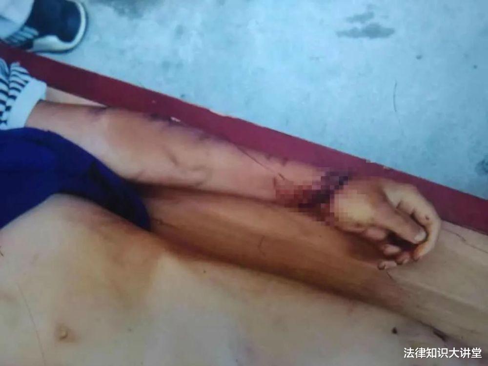 法律知识大讲堂 12岁男童被亲生父母虐待，惨死家中，被告一审获刑6年