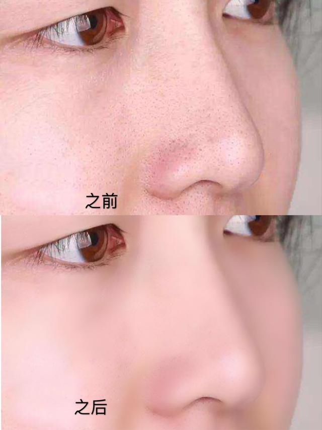 好物官|李沁红裙亮相,高清摄像机下皮肤成焦点,如玉肌肤如何养成