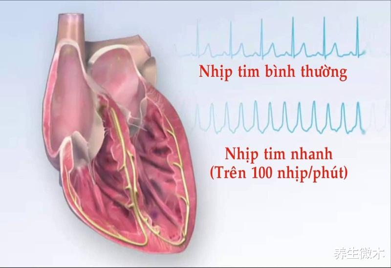 运动|人们运动的时候,心率保持在多少是健康的?听专家如何介绍
