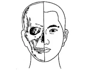脑卒中|针灸穴位治疗各类痛证