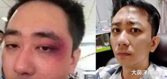 |女星曝曾遭男友施暴，被掐脖拿艳照威胁，表示：现在会更暴力还击