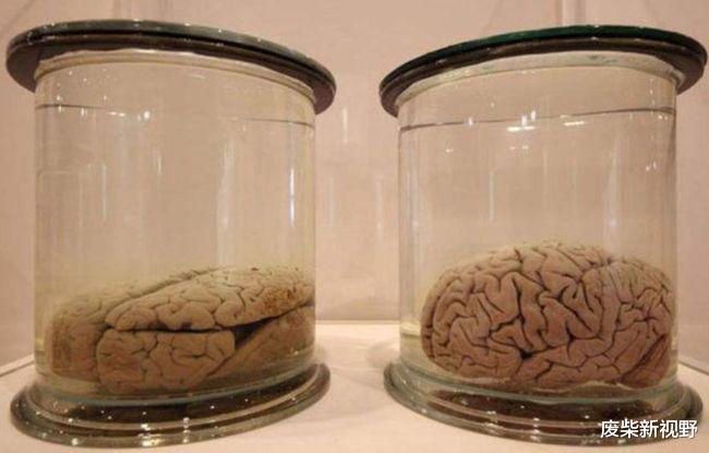 爱因斯坦 当年偷走爱因斯坦大脑，将其切成240片的人有何发现？65年后才知道答案