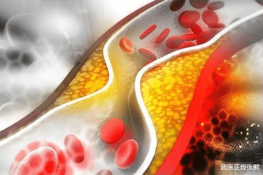 血糖|血脂“劲敌”已公布,不是萝卜,心内科专家:若常吃,可让血管通畅