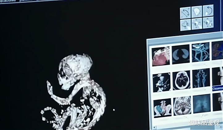 科学家 外星宝宝事件1：农夫捕获一只未知生物，将其淹死后自己离奇身亡