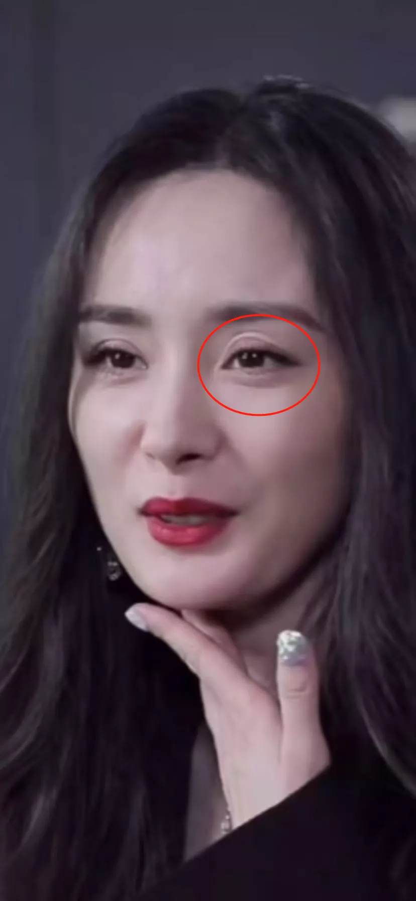 杨幂|杨幂的眼睛怎么了？出现怪异褶皱双眼不对称，再引网友整容质疑