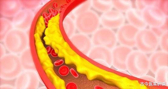 燕麦|血管“保护伞”终于被找到，并非燕麦，常吃这“1物”，帮助降血脂