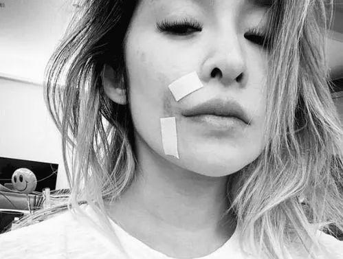 郑绪岚|明星毁容后现状不同，胡歌已成视帝，李依晓却变“坏女人专业户”