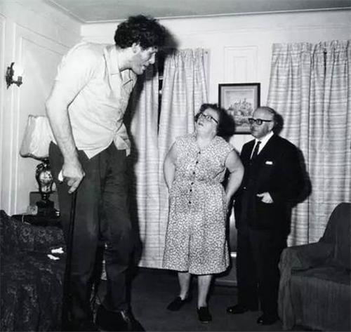 侏儒症 全球唯一的“侏儒巨人”,21岁只有1.22米,33岁达到了2.18米