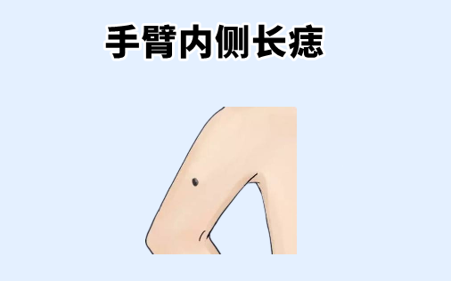 中国易经风水|身体5颗“福禄”痣，一个添财，一个增福，吃穿不愁，儿女双全！