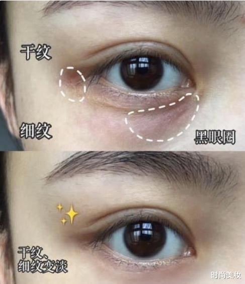 眼霜|“戚薇式”涂眼霜方法走红,看完她的“步骤”,网友:长知识了