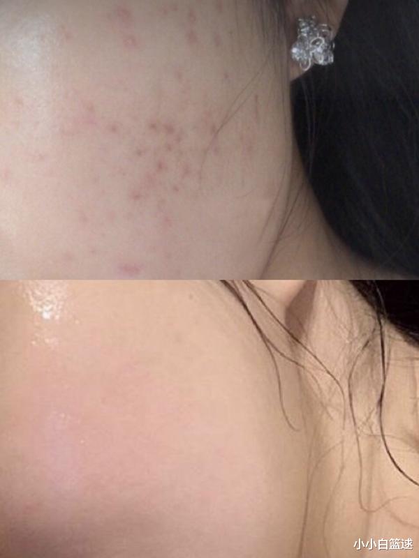 爽肤水|精华液为啥不能直接涂脸？看看这2点，网友：中一个皮肤就会变差