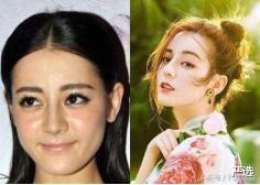 严选|为抗老注射“玻尿酸”变面瘫的女人,现在啥样?过来人:追悔莫及