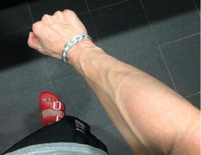 医生|有些人手臂“青筋暴起”,有些人却看不到“青筋”,医生给你科普